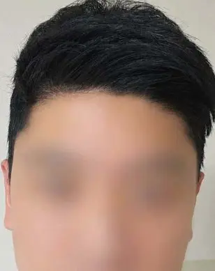 헤어 시술 후 고객 리뷰 사진 1