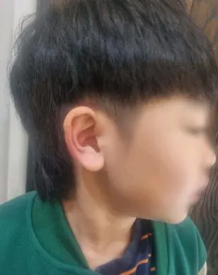 헤어 시술 후 고객 리뷰 사진 1